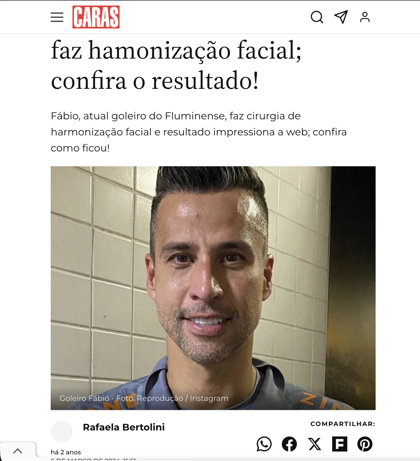 Matéria Caras sobre harmonização facial do goleiro Fábio